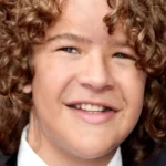 noonan syndrome celebrities