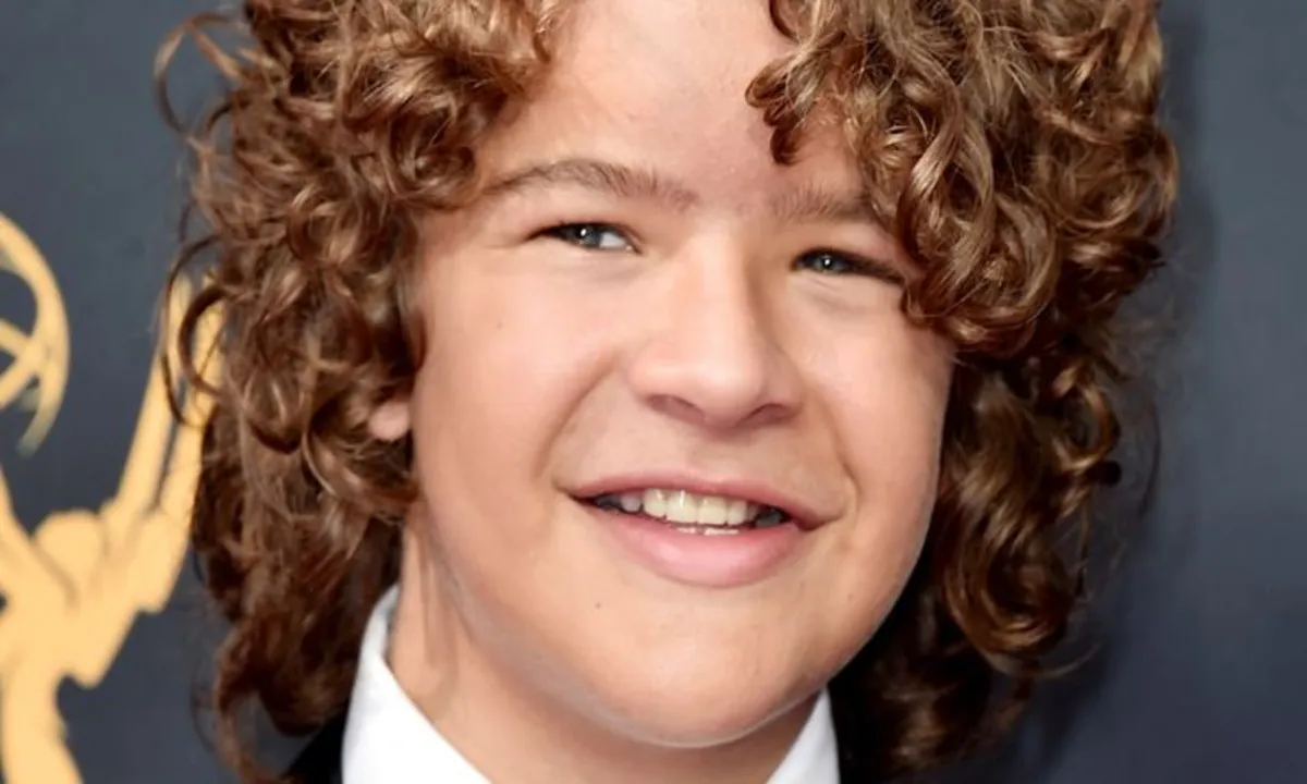noonan syndrome celebrities